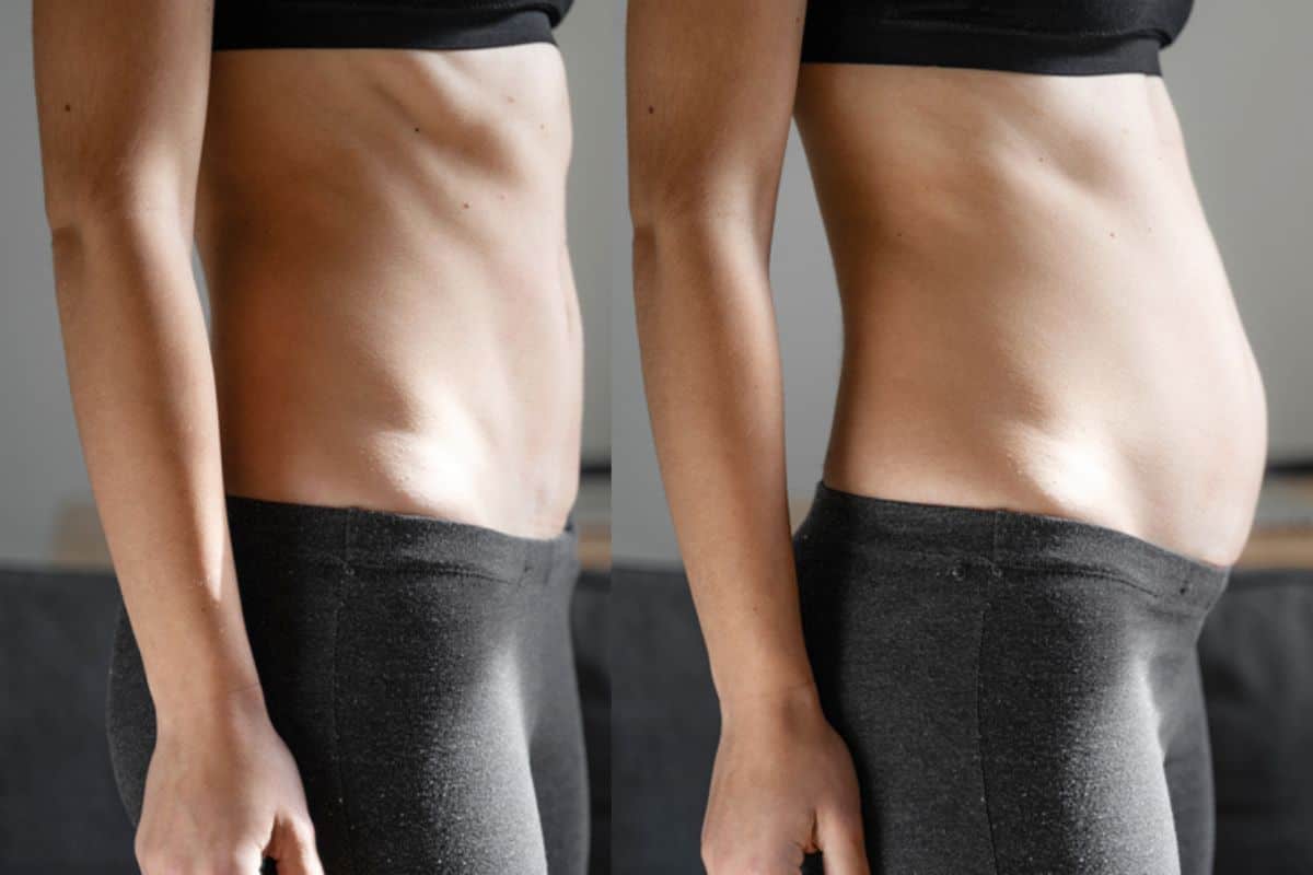 How long does diastasis recti take to improve Royal Wootton Bassett?