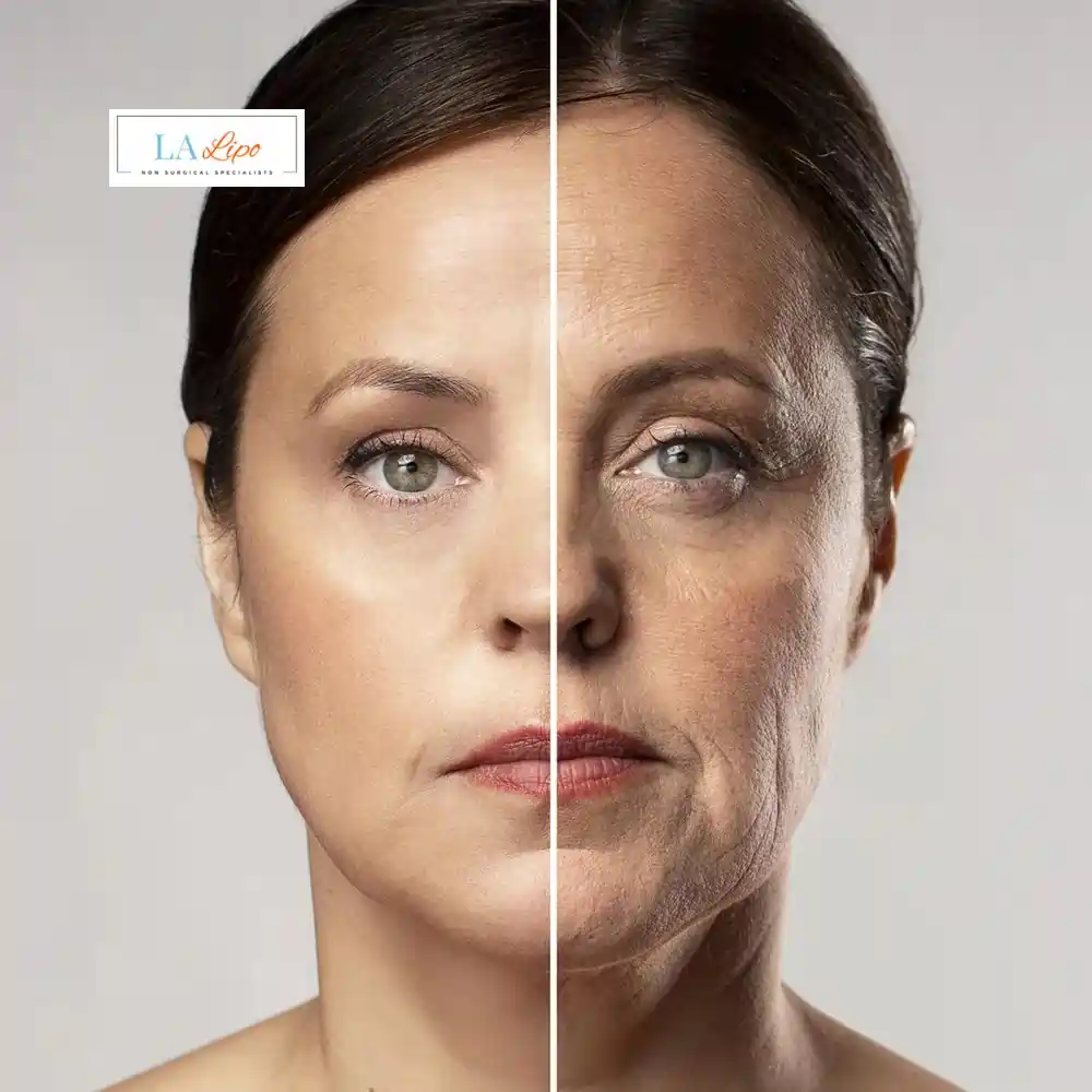 How Can You Tell If Non-Surgical Skin Tightening Is Right for You Royal Wootton Bassett?