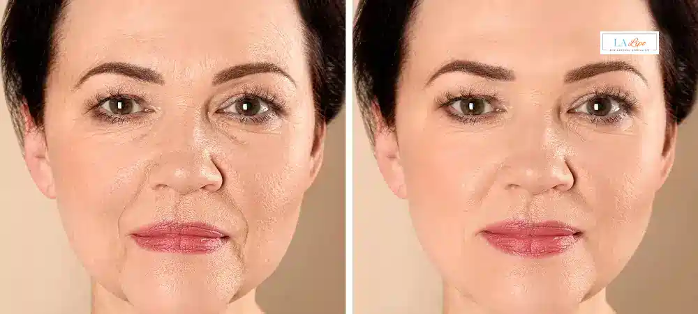 How Long Does It Take to See Results and How Long Do They Last Royal Wootton Bassett?