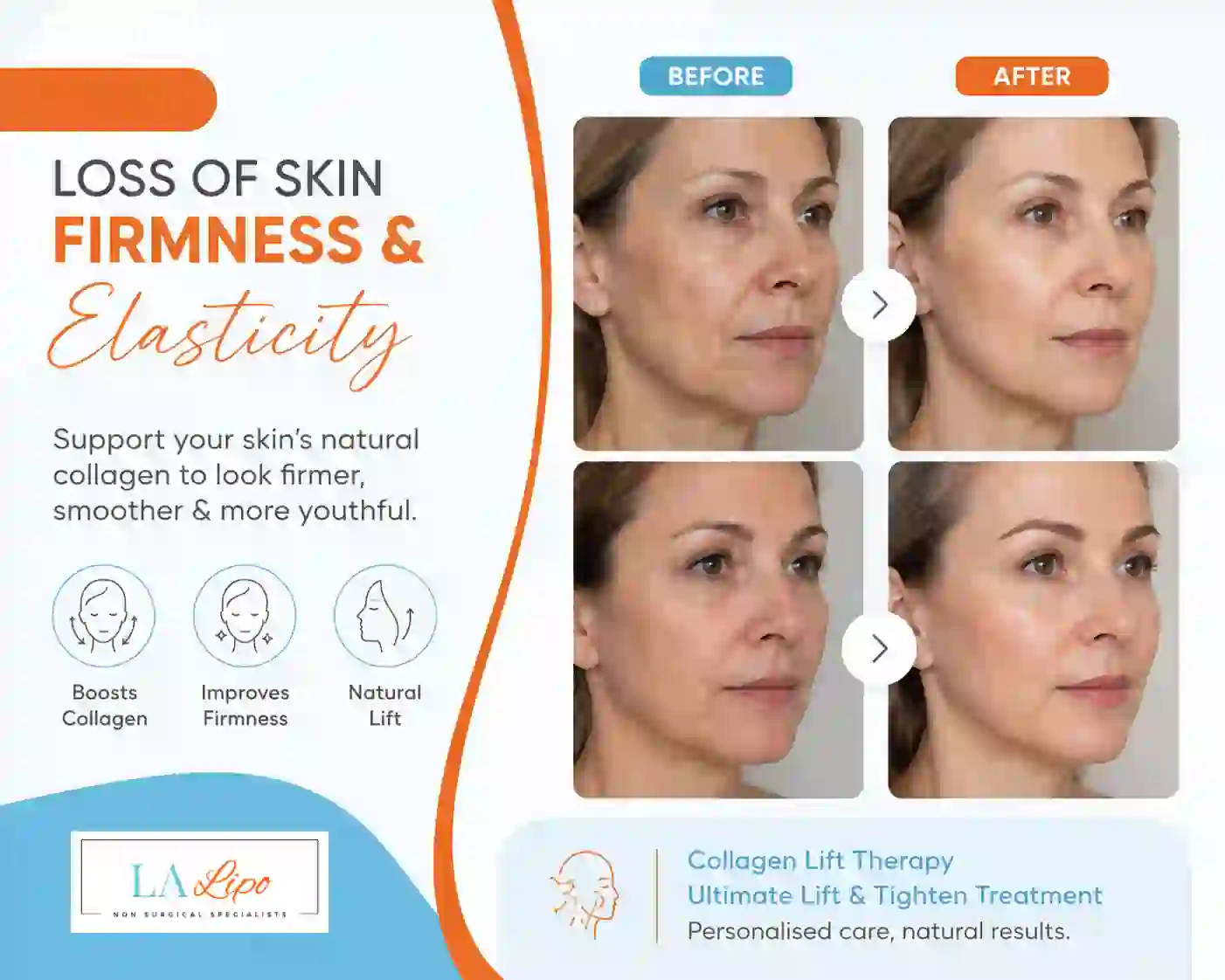 Sign #7: Loss of Skin Firmness and Elasticity Royal Wootton Bassett